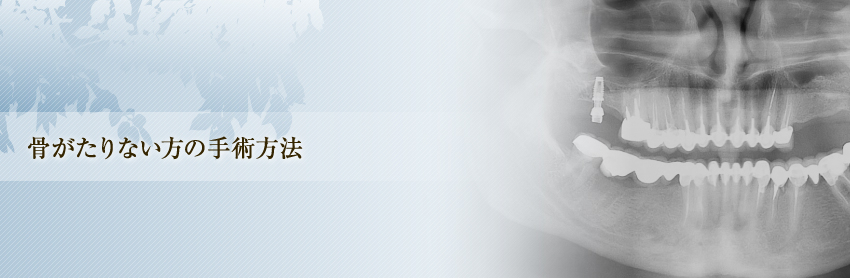 骨がたりない方の手術方法