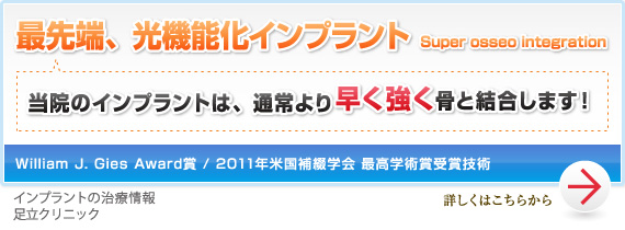 最先端、光機能化インプラント なぜ足立歯科のインプラントは早く強力にくっつくのか？