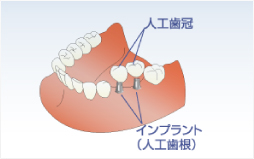 最適な手術方法