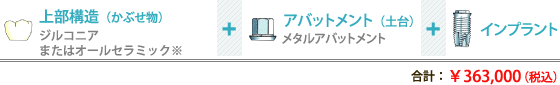 1.上部構造（かぶせ物）+ 2.アバットメント（土台）+ 3.インプラント = 合計¥352,000～¥407,000