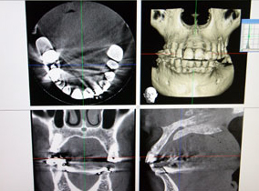 DXマルチイメージマイクロCT写真