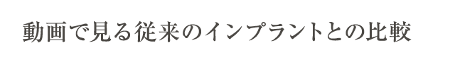 動画で見る従来のインプラントとの比較