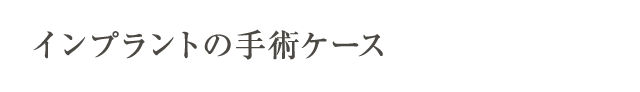 インプラントの手術ケース